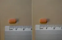 TARGIN 20 mg/10 mg COMPRIMIDOS DE LIBERACION PROLONGADA - Imagen 2