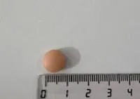 SITAGLIPTINA TECNIMEDE 100 MG COMPRIMIDOS RECUBIERTOS CON PELÍCULA EFG - Imagen 2