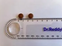 ELTROMBOPAG DR. REDDYS 75 MG COMPRIMIDOS RECUBIERTOS CON PELÍCULA EFG - Imagen 2