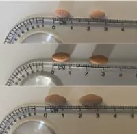 APREMILAST DR. REDDYS 10MG + 20MG + 30MG COMPRIMIDOS RECUBIERTOS CON PELICULA EFG - Imagen 2